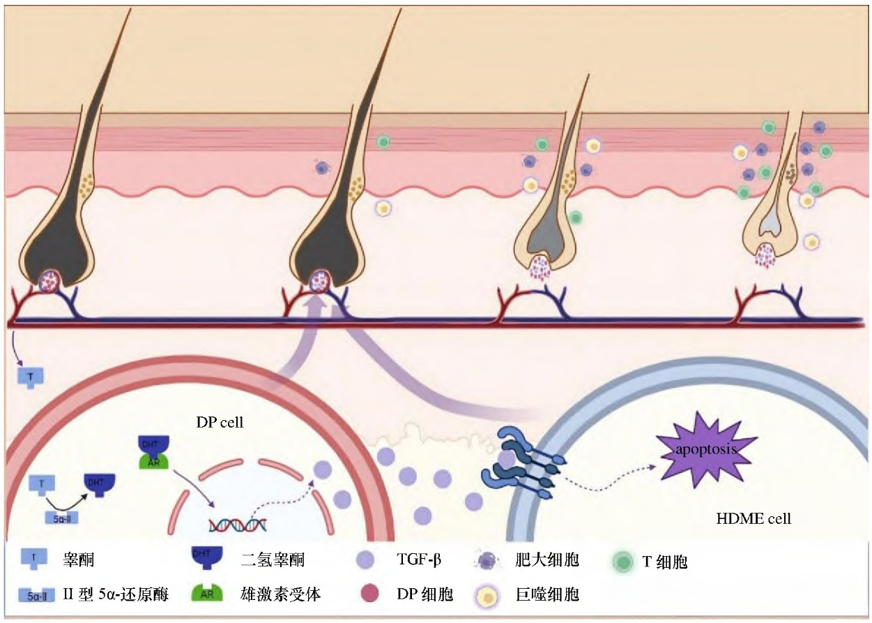 90% of Hair Loss is Because of This! Advances in Research on Androgenetic Alopecia and Introduction to AGA Animal Models