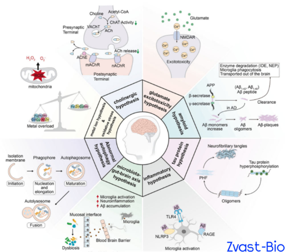 Discovery of Alzheimer Disease and New Drug Developments