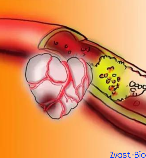 Macrophage ADAM8: A Key Inhibitory Target for Post-Myocardial Infarction Repair