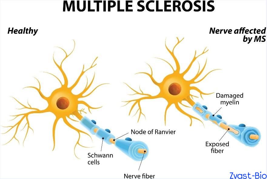 Accelerating MS R＆D in 2025: Translating EAE Insights into Clinical Candidates