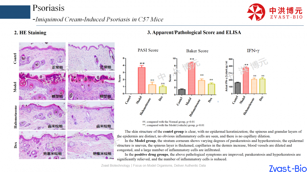 psoriasis model in autoimmune skin disease data summary-2025_06.png