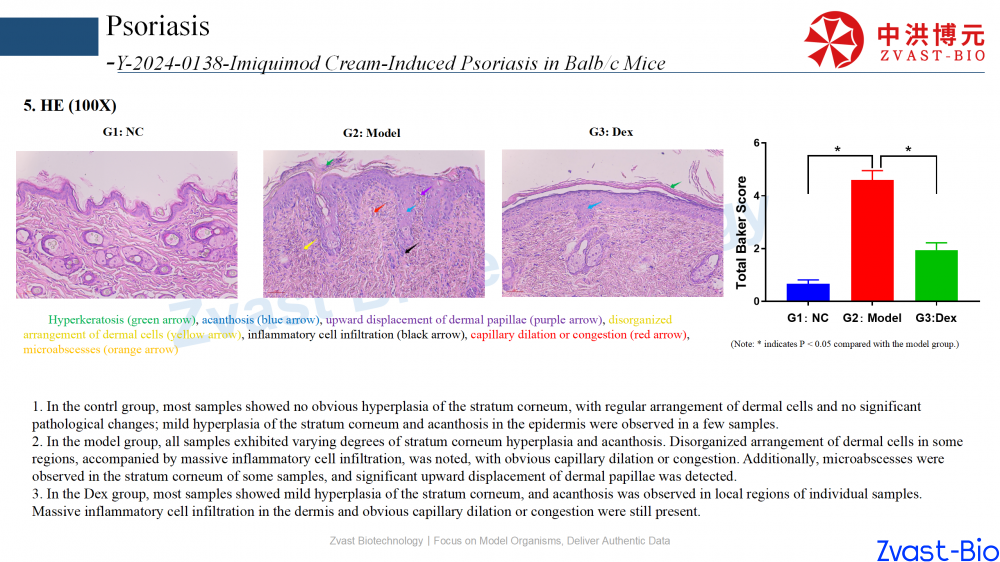 psoriasis model in autoimmune skin disease data summary-2025_15.png
