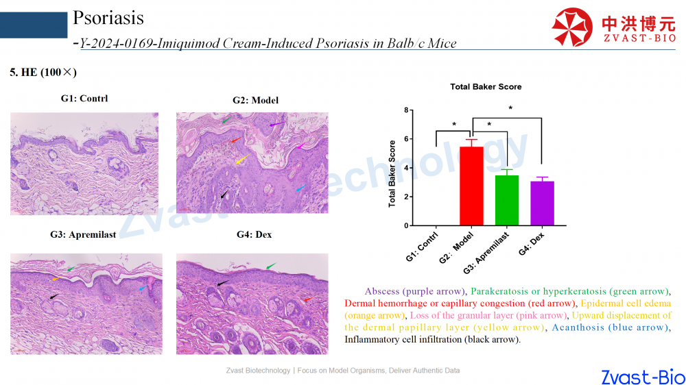 psoriasis model in autoimmune skin disease data summary-2025_19.png