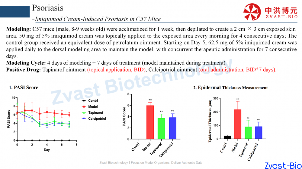 psoriasis model in autoimmune skin disease data summary-2025_10.png