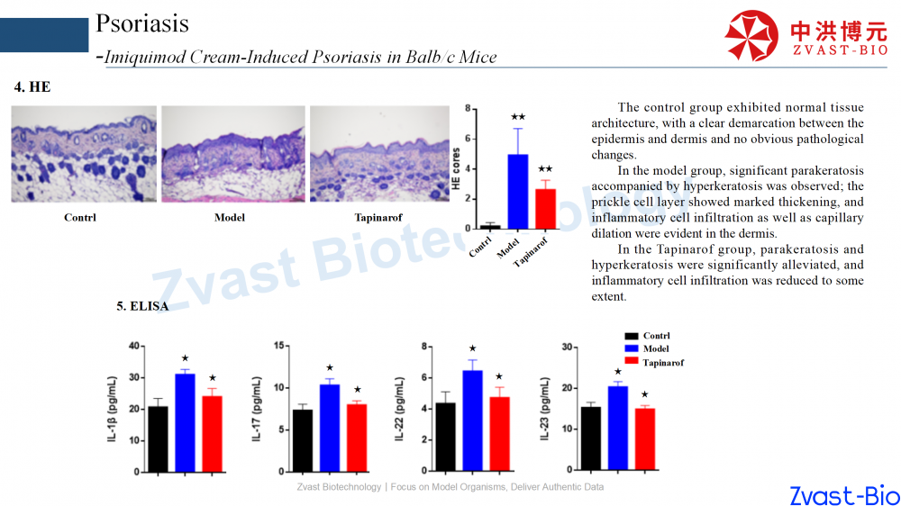 psoriasis model in autoimmune skin disease data summary-2025_09.png