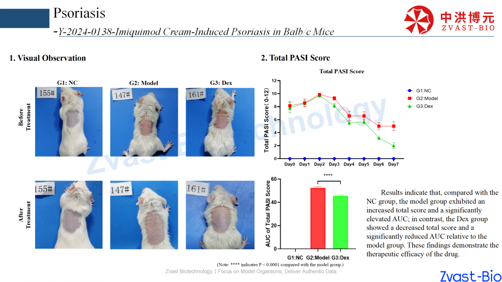 psoriasis model in autoimmune skin disease data summary-2025_13.png
