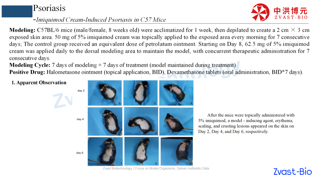 psoriasis model in autoimmune skin disease data summary-2025_05.png