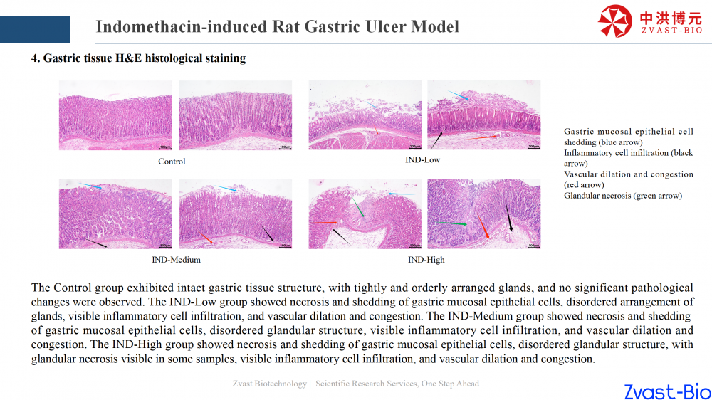 gastric ulcer model_14.png
