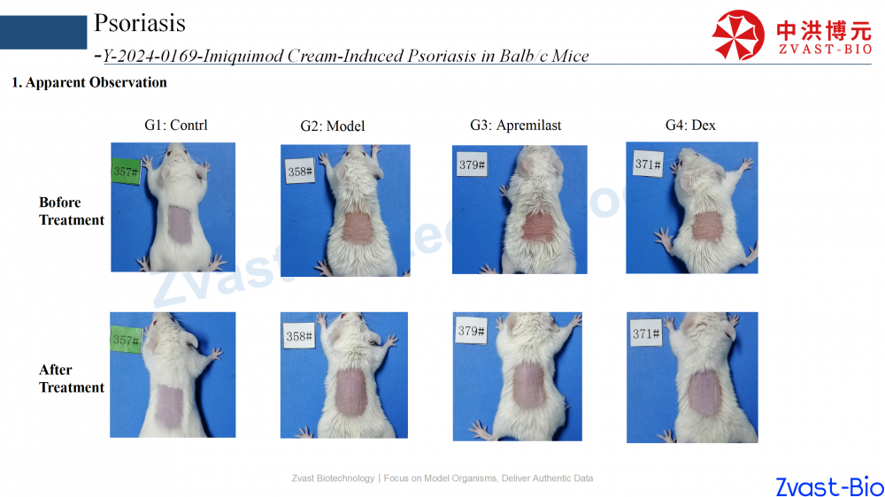 psoriasis model in autoimmune skin disease data summary-2025_17.png