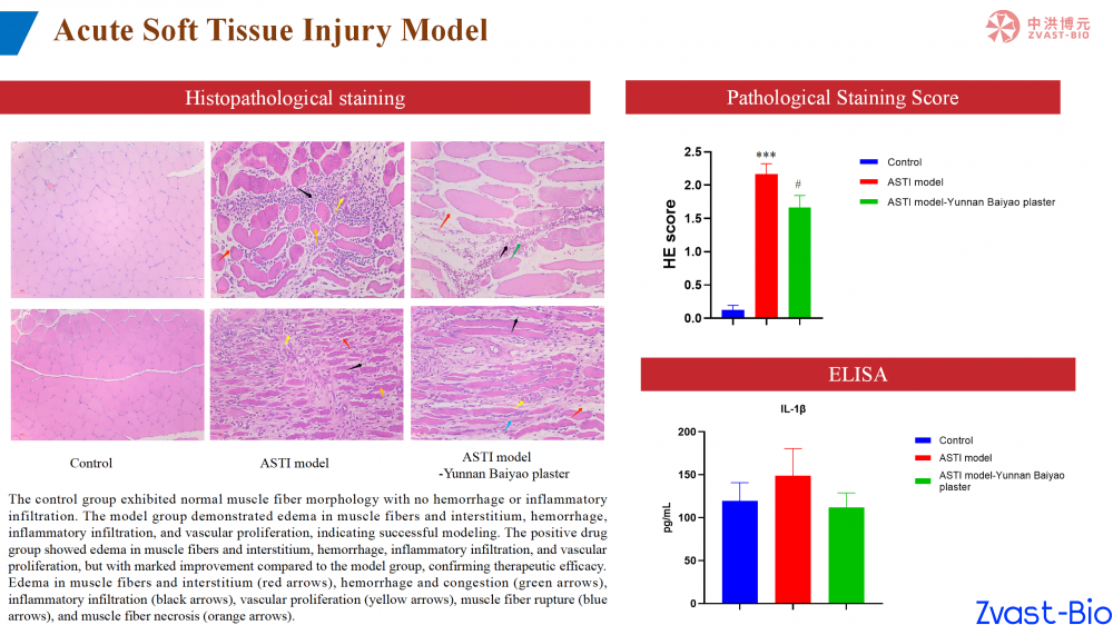 acute soft tissue injury model_02.png