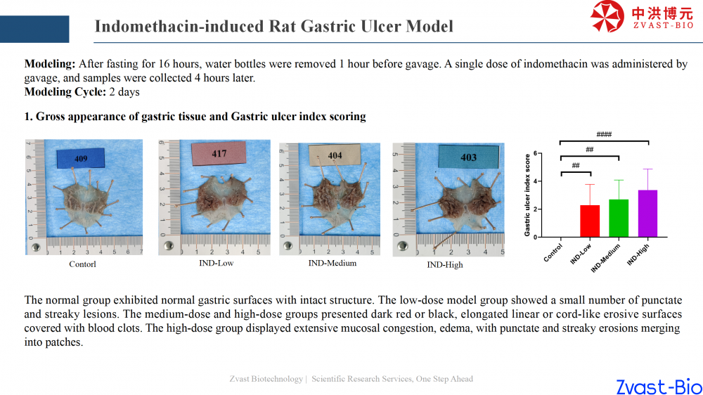gastric ulcer model_12.png