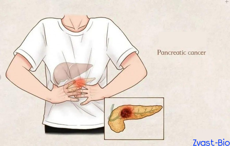 Conquering Undruggable Targets! Pancreatic Cancer Drugs Deliver Stunning Efficacy