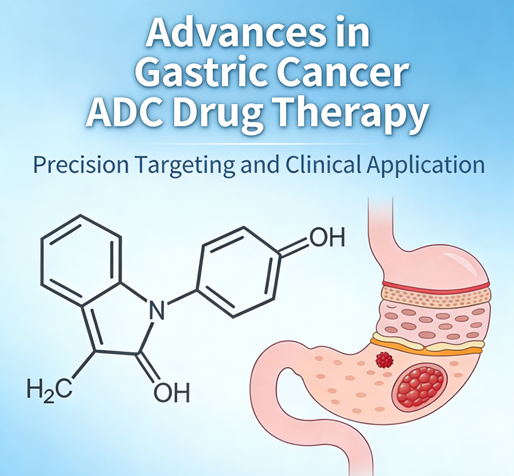 New Advances in Gastric Cancer: ADC Drugs Lead Breakthroughs in Research and Clinical Practice