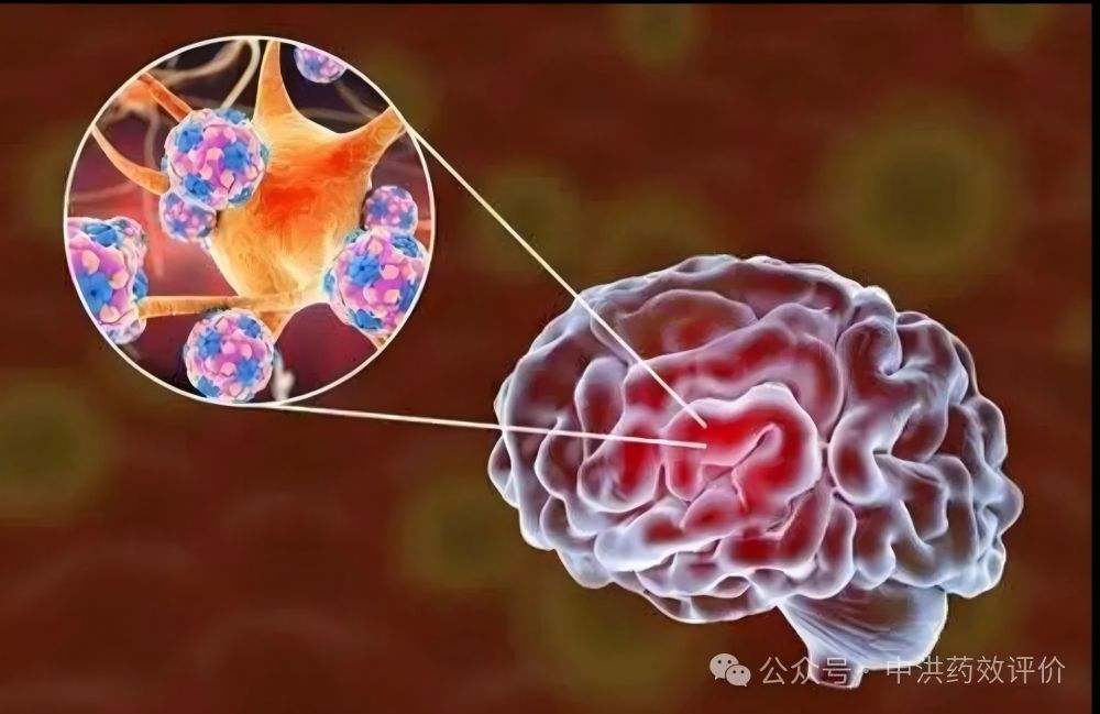 Reshaping Immune Homeostasis: A New Era of Precision Treatment for Neuroimmune Diseases