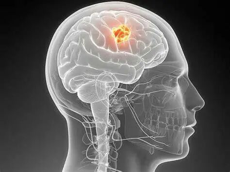 Breakthrough in glioma treatment: from the intracranial black box to precise targeting, multi-path breakthroughs rewrite patients fate